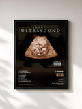 #noir Tableau de l'album Ultrasound de Loonie, cadre noir, imprimé et encadré en France